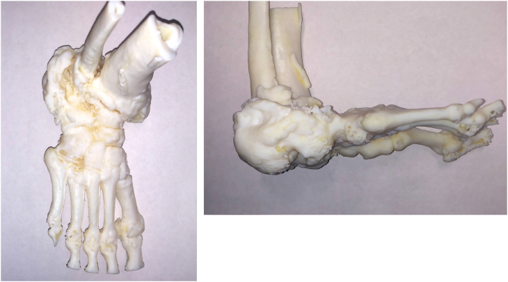 Fig. 1A and b