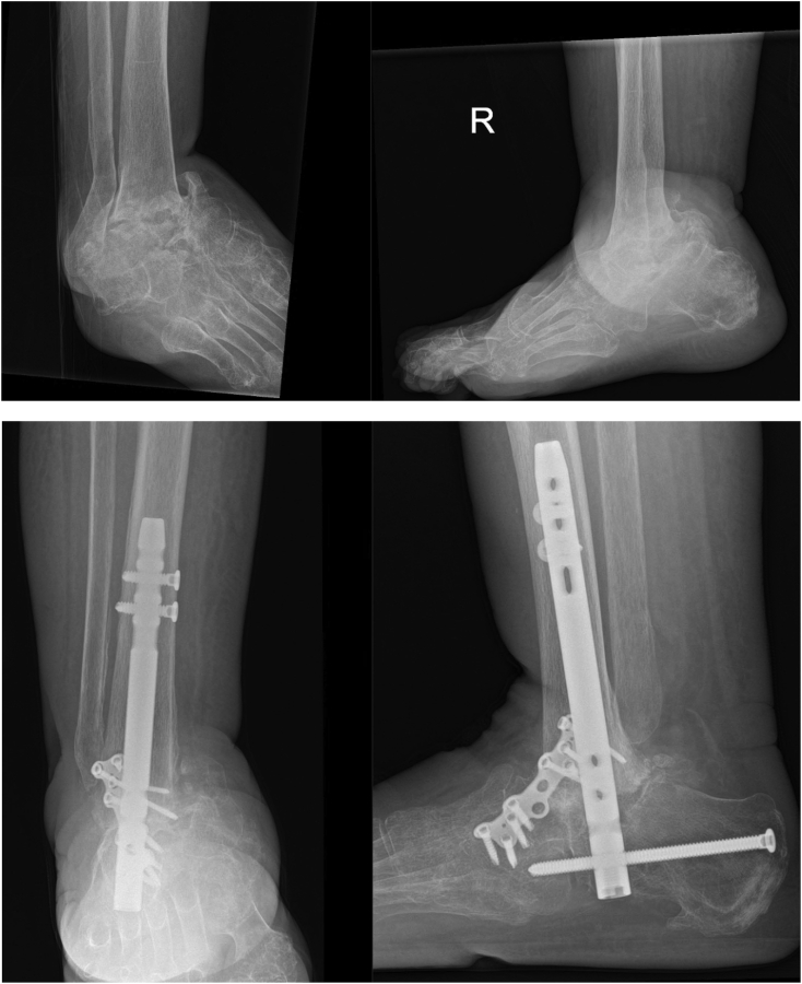 Fig. 7A and b