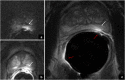 Fig. 15