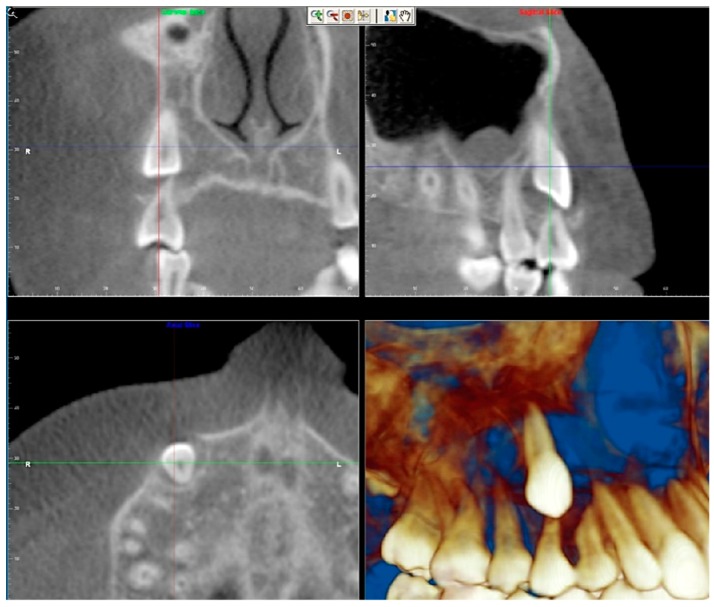 Figure 21