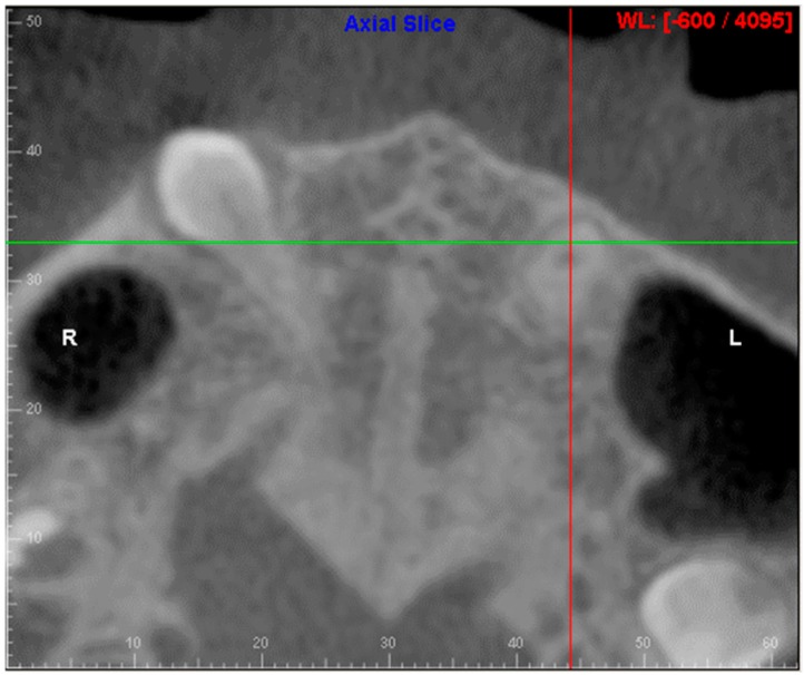 Figure 24