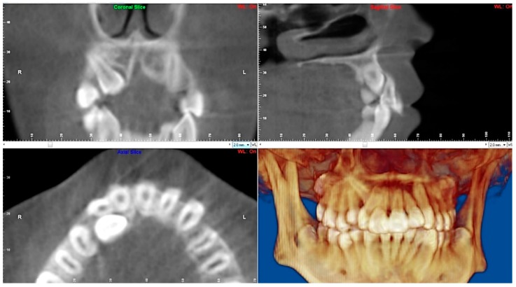 Figure 28