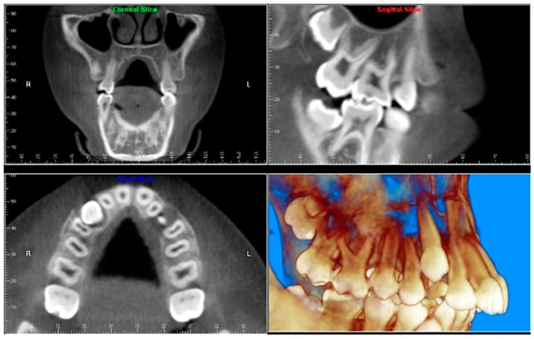 Figure 12