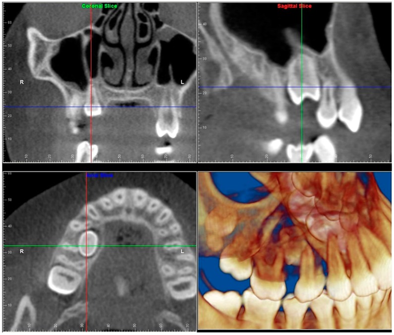 Figure 26