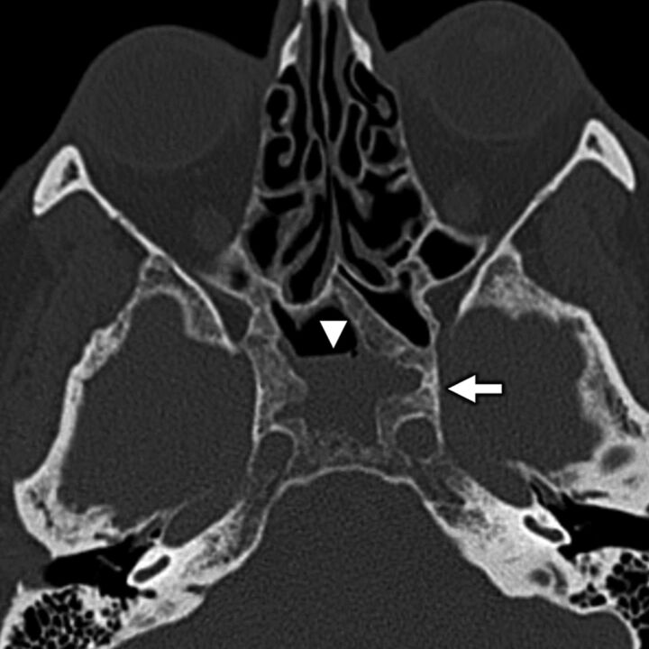 FIG 11.