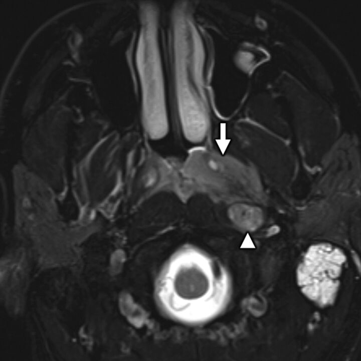 FIG 12.