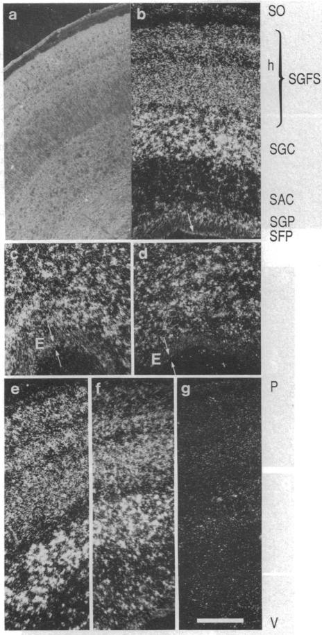 graphic file with name pnas00290-0540-a.jpg