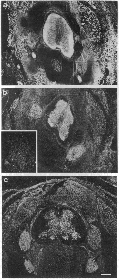 graphic file with name pnas00290-0539-b.jpg