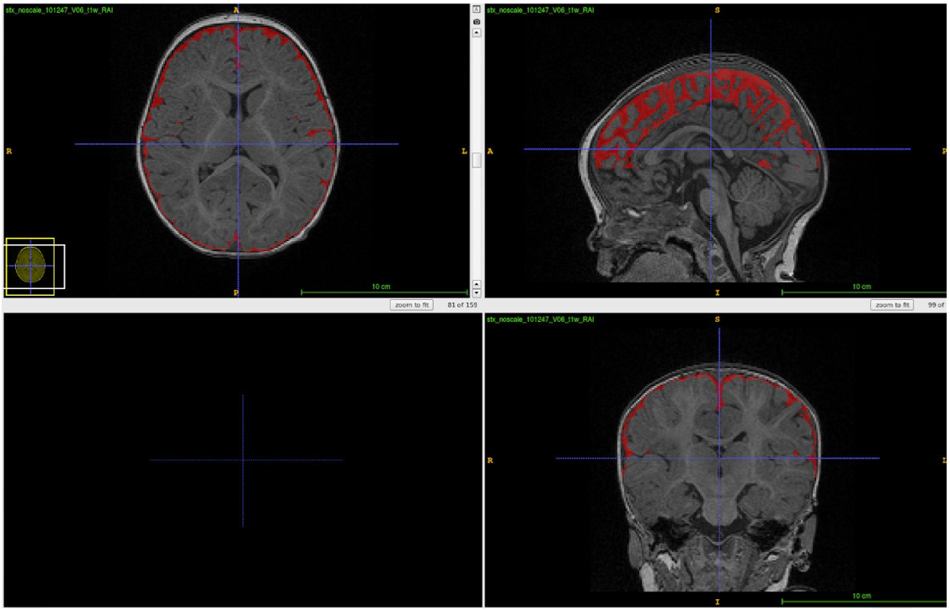 Figure 4: