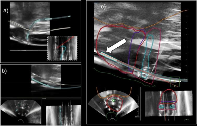 Fig. 3