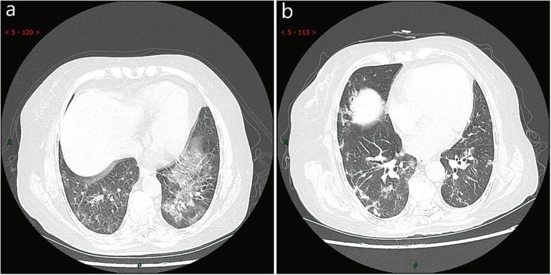 Fig. 10