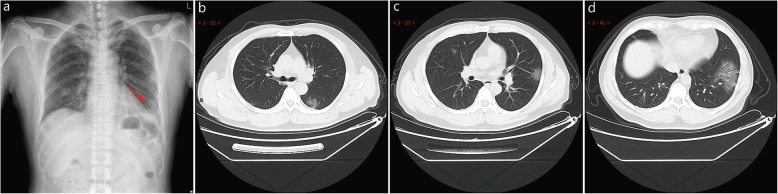 Fig. 2