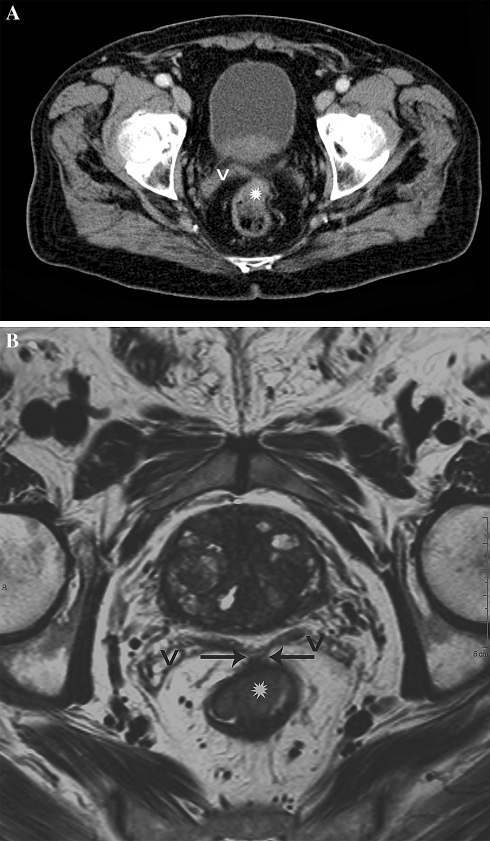 Fig. 3.