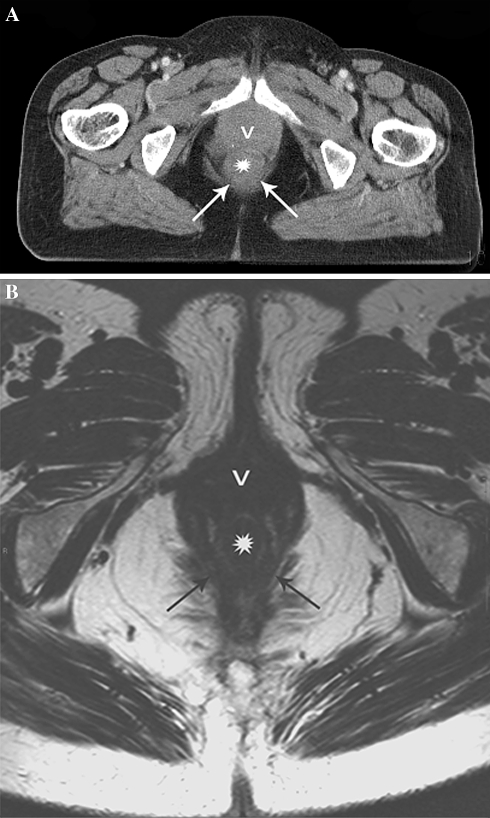 Fig. 4.