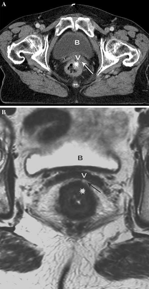 Fig. 2.