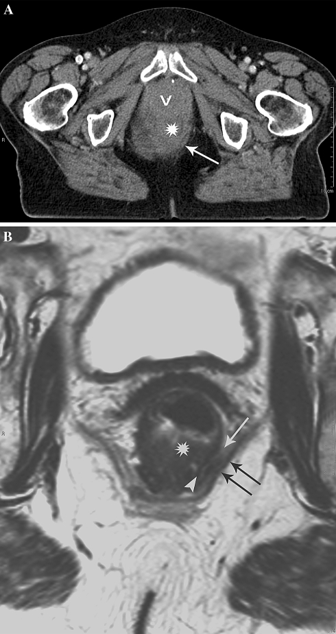 Fig. 1.