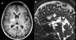 Figure 11.