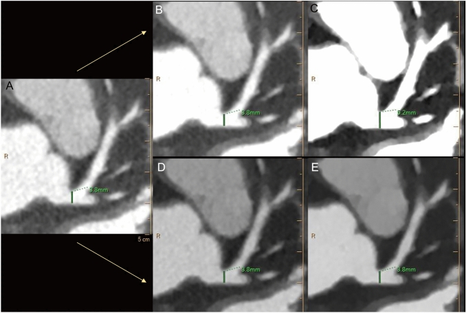 Fig. 4