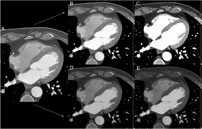 Fig. 3