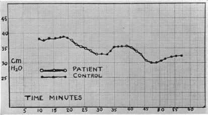 CHART 2.