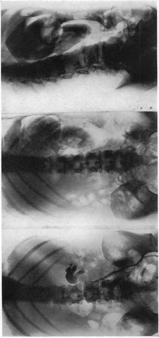 FIG. 3, 2, 1.