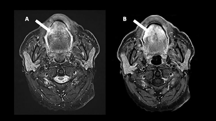 Fig 5