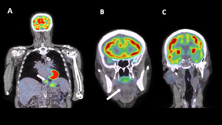 Fig 1: