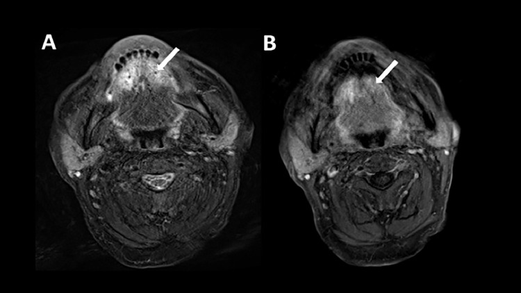 Fig 2: