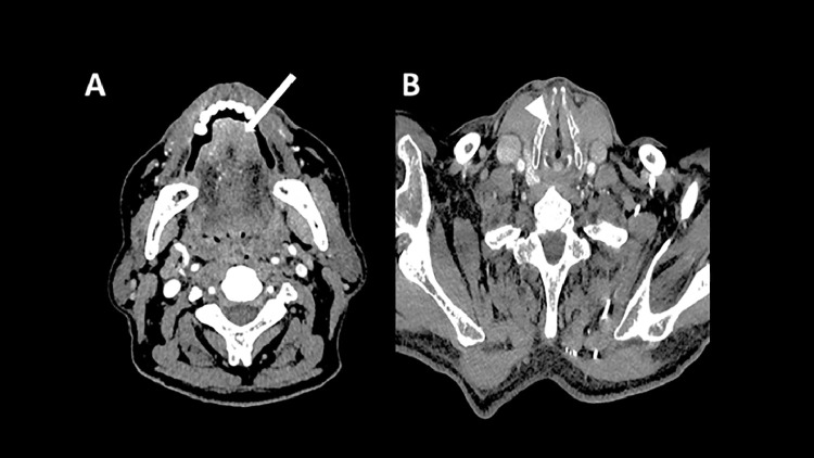 Fig 3: