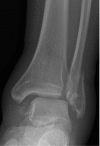 Fig. 6