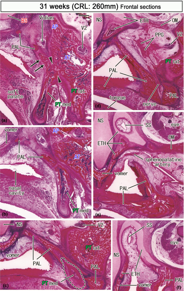 FIGURE 11