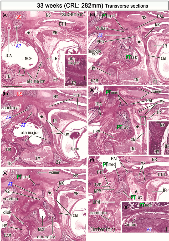 FIGURE 10