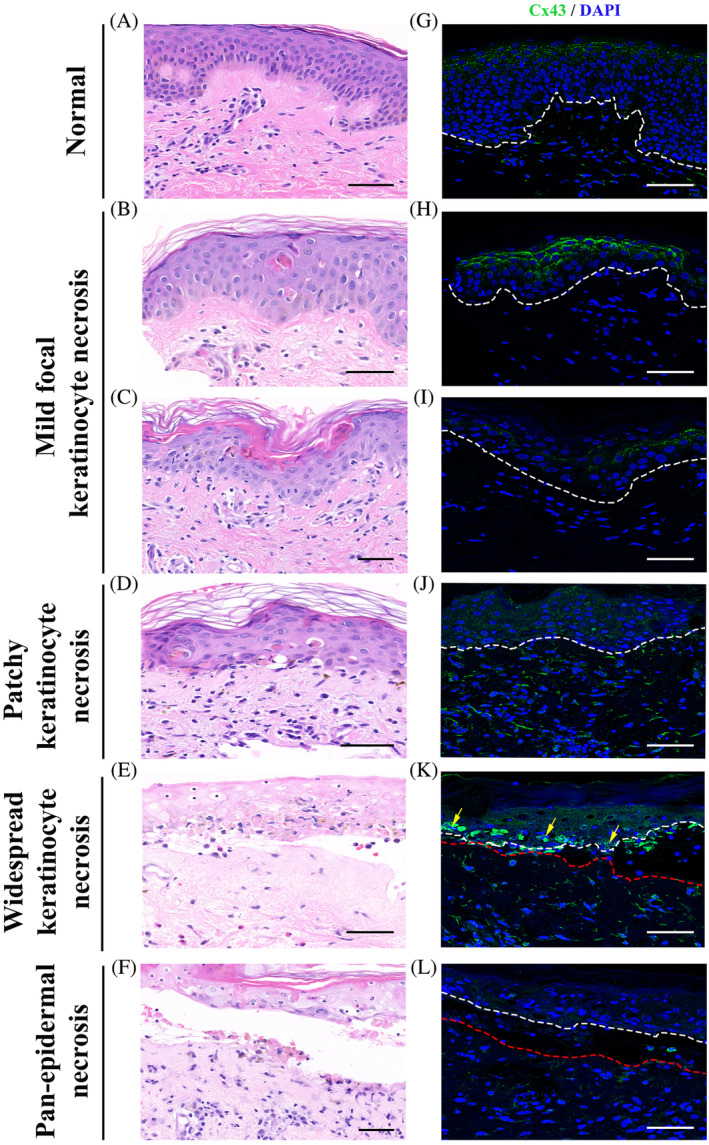 FIGURE 3