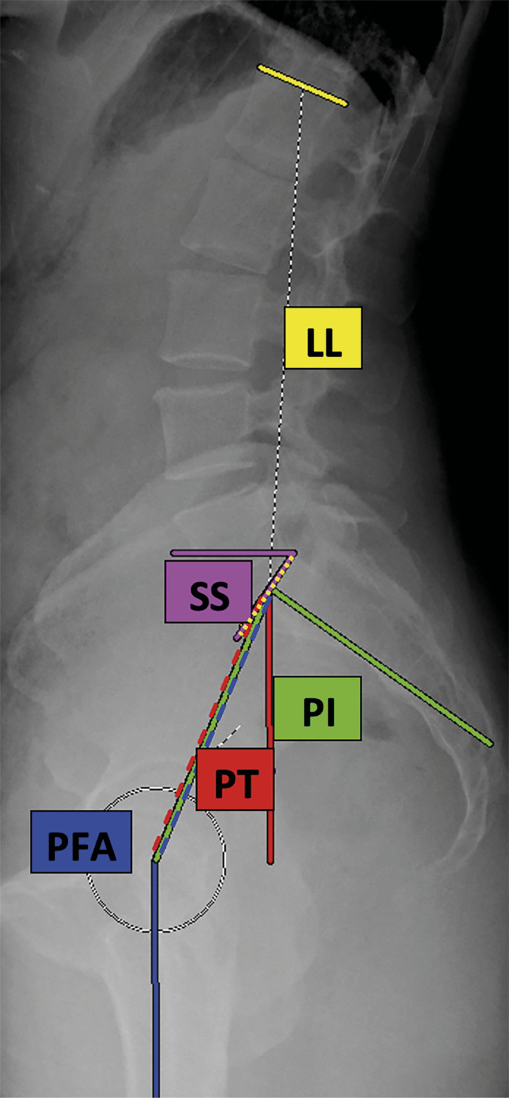 Fig. 1-A and Fig. 1-B