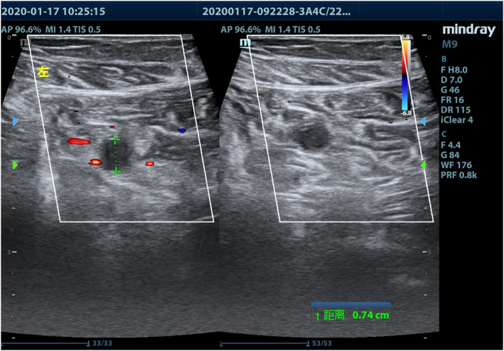 FIGURE 2