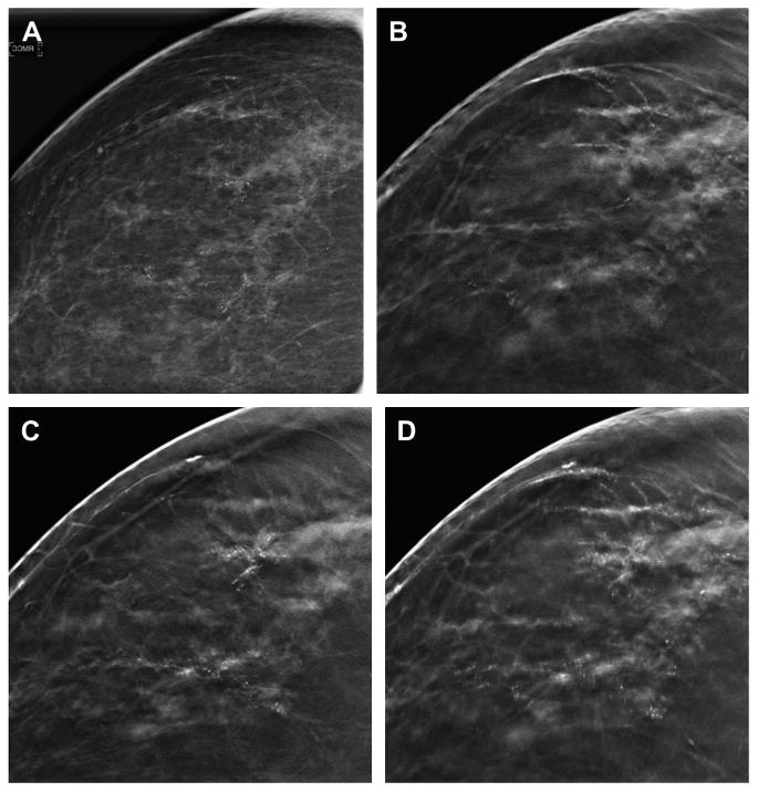 Fig. 11