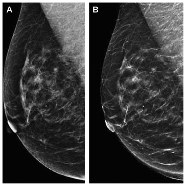 Fig. 12