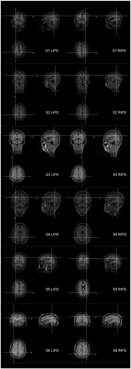 Supplementary Figure