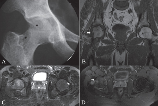 Figure 2 (A-D)