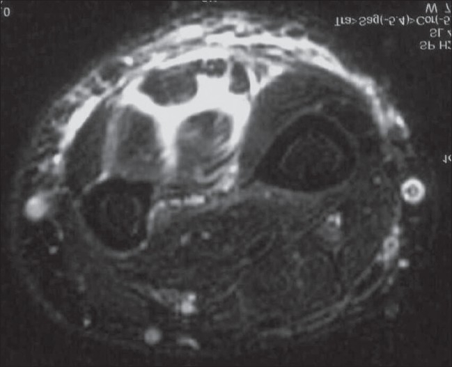 Figure 16