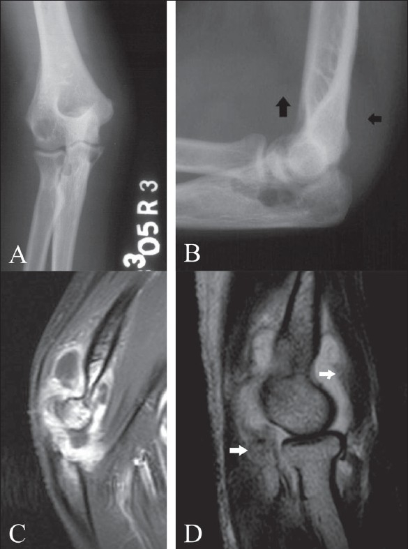 Figure 5 (A-D)