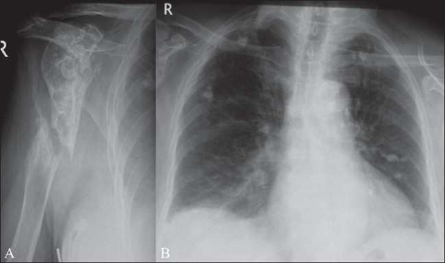 Figure 1 (A,B)