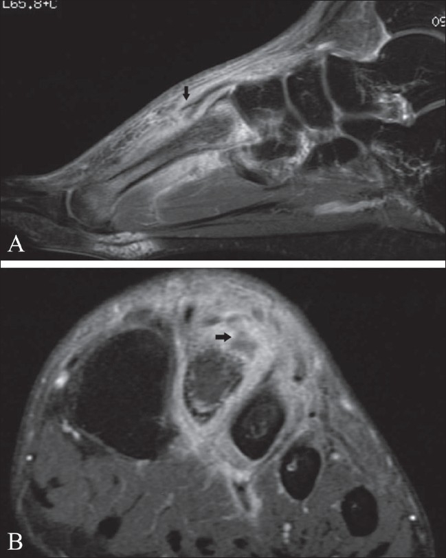 Figure 13 (A,B)