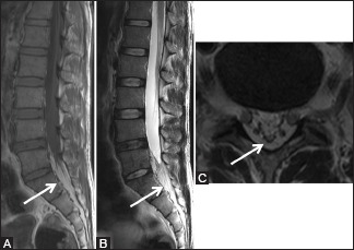 Figure 15 (A-C)