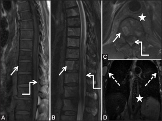 Figure 19 (A-D)