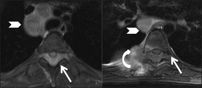 Figure 10b