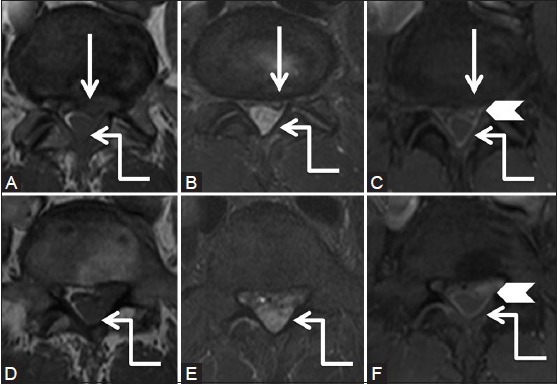 Figure 3b (A-F)