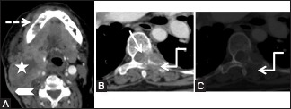 Figure 21 (A-C)