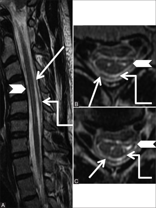 Figure 27 (A-C)