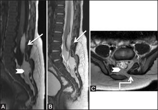 Figure 16 (A-C)